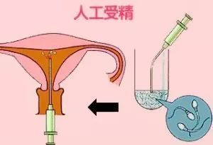 济南捐卵试管中心医院