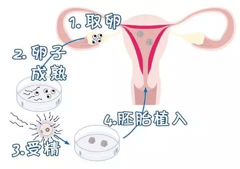 上海捐卵电话
