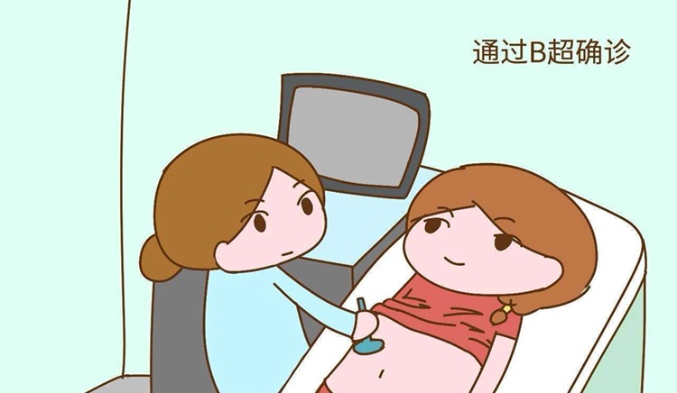 捐卵女孩