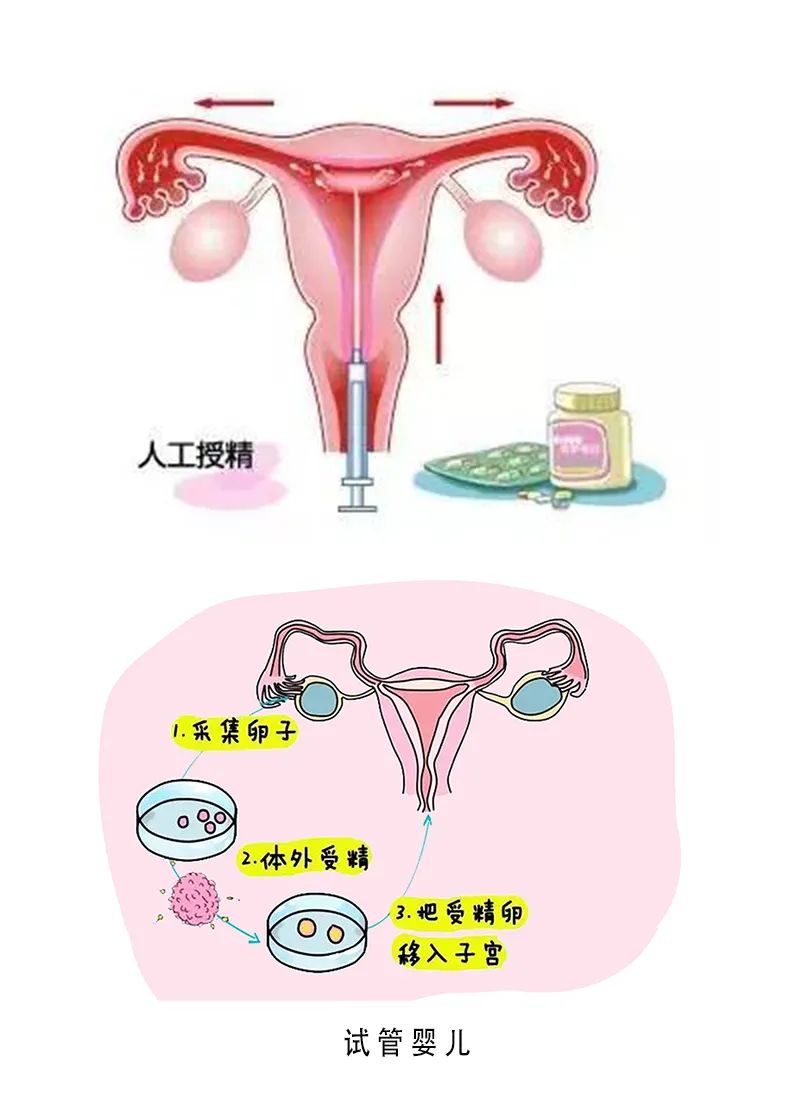 备孕
