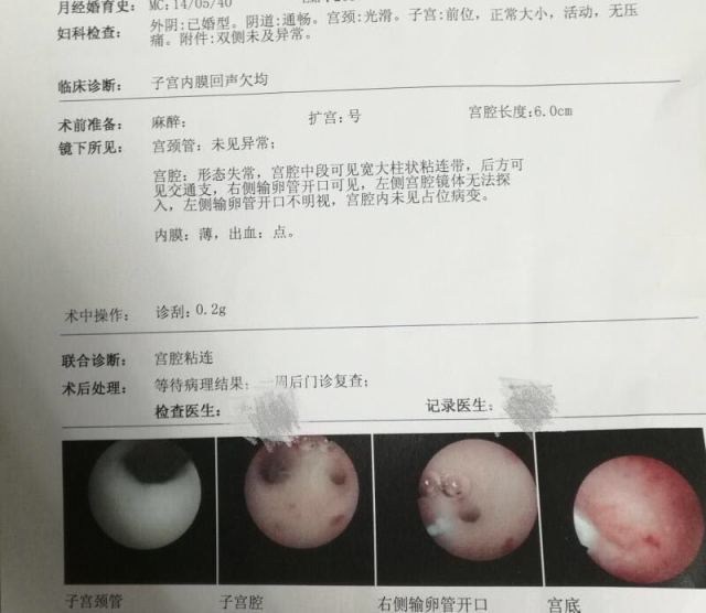 汕头捐卵公司
