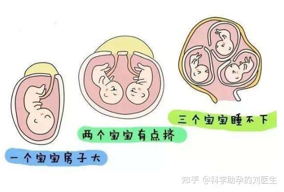 甲减