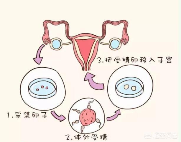 菏泽捐卵公司电话